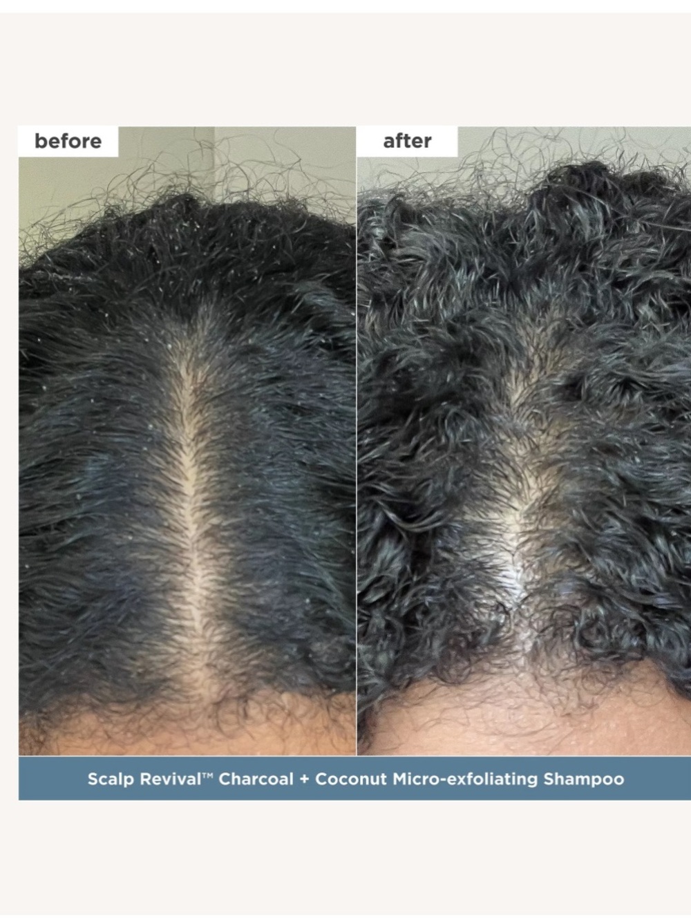 Briogeo Healthy Hair Delights 2 scalp revival + don’t despair repair boxed set - Picture 5 of 10